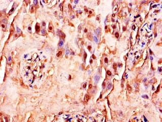 FLT4 / VEGFR3 Antibody