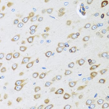 Osteoglycin / Mimecan Antibody