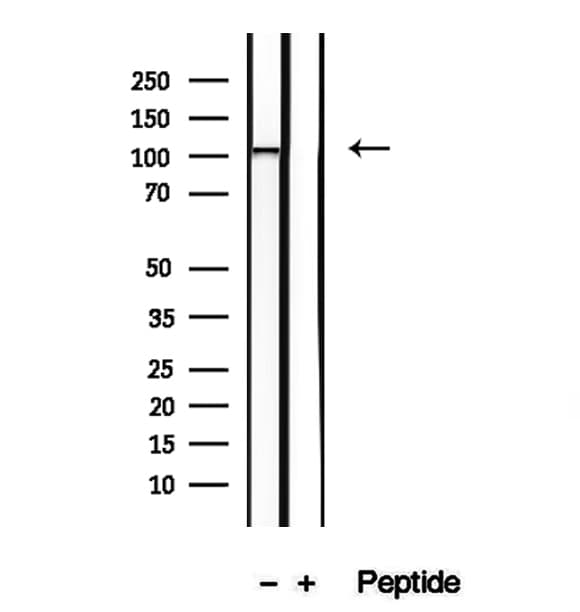 NAT10 Antibody