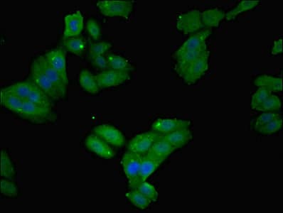 IHC-plus™ Polyclonal Rabbit anti-Human FTL / Ferritin Light Chain Antibody (IHC, WB)