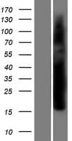Human VGLL4 Protein (Over-Expression Lysate Myc-DDK (Flag))