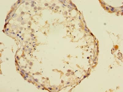 Polyclonal Rabbit anti-Human TCN1 Antibody (IHC)