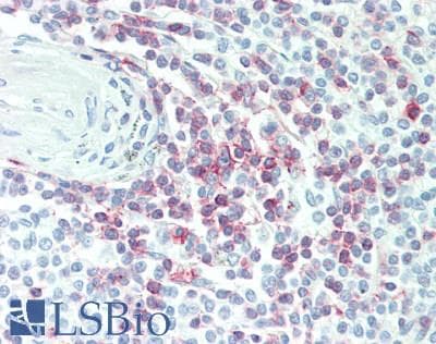 PathPlus™ CD2 Antibody