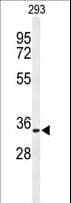 IHC-plus™ Polyclonal Rabbit anti-Human Prohibitin 2 / PHB2 Antibody (Tyr128, IHC, WB)