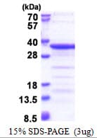 Human TAF15 Protein (Recombinant His)
