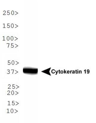 KRT19 / CK19 / Cytokeratin 19 Antibody (DY488)