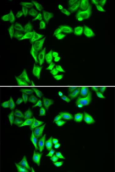 STRN3 Antibody