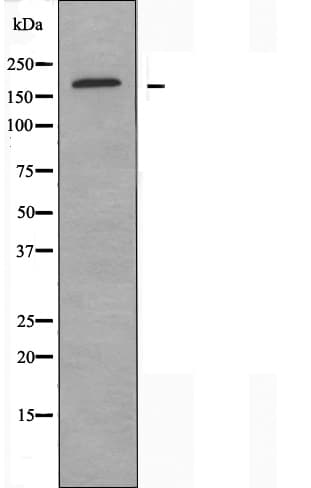 ADGRB1 / BAI1 Antibody
