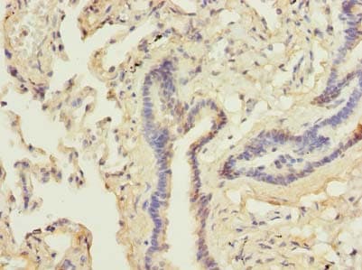 Polyclonal Rabbit anti-Human DDX42 Antibody (IHC)