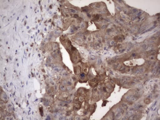 LGALS3 / Galectin 3 Antibody (clone OTI8D7)