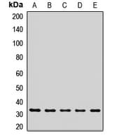 RSU1 Antibody