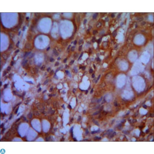 CHD3 Antibody