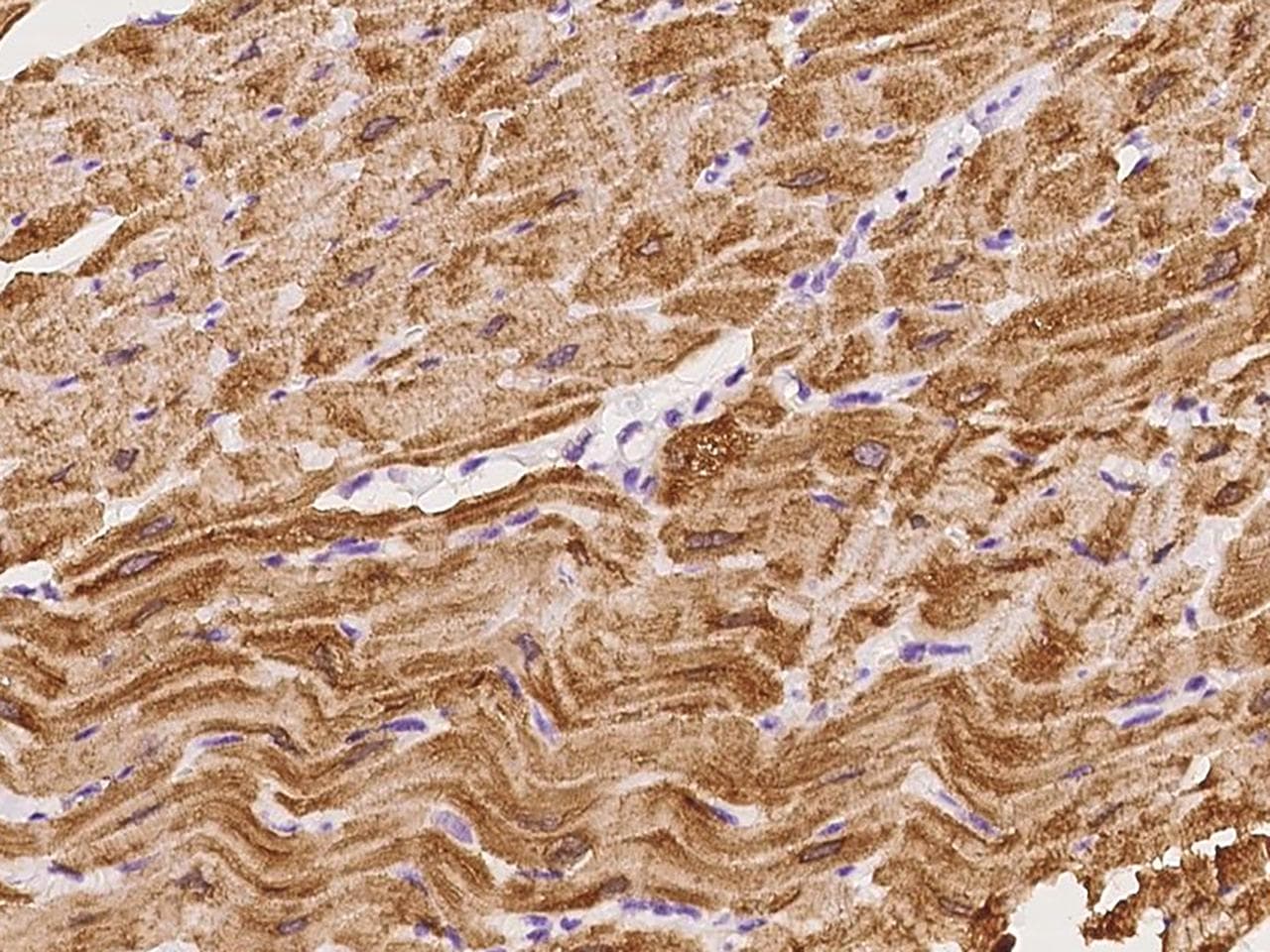 Polyclonal Rabbit anti-Human SMYD1 Antibody (IHC)