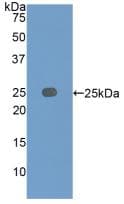 IGFBP7 / TAF Antibody (aa88-281)