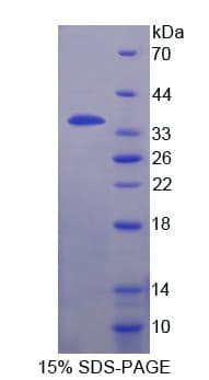 Human FIGN / Fidgetin Protein (Recombinant His-T7)