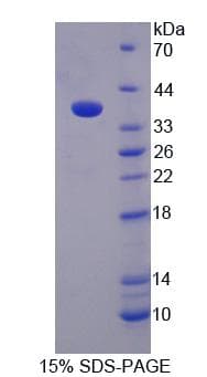 Rat CASC1 Protein (Recombinant His, N-Terminal)
