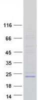 Human PIGH Protein (Recombinant Myc-DDK (Flag))