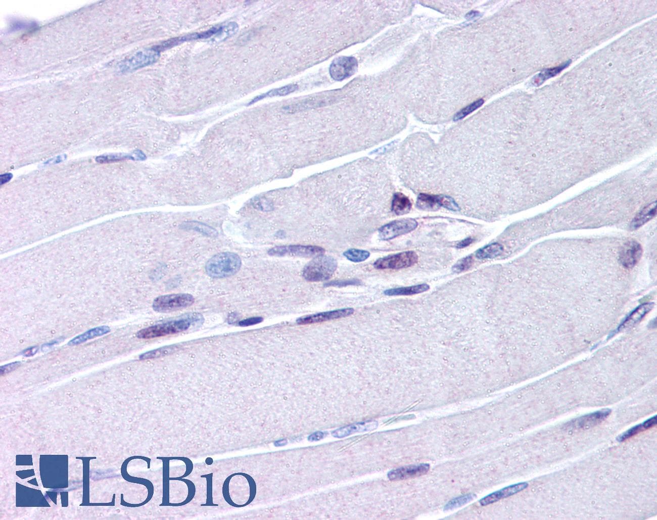 IHC-plus™ Polyclonal Rabbit anti-Human NR4A1 / NUR77 Antibody (aa251-266, IHC, IF, WB)