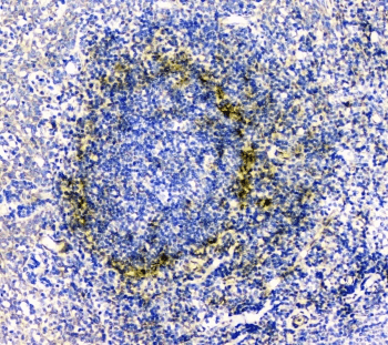 Polyclonal Rabbit anti-Human IL34 Antibody (IHC, WB)