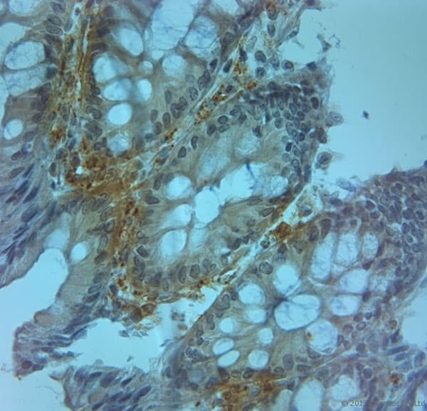 TJP2 / ZO2 / ZO-2 Antibody (aa740-790)