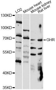 Polyclonal Rabbit anti-Human Growth Hormone Receptor / GHR Antibody (WB)