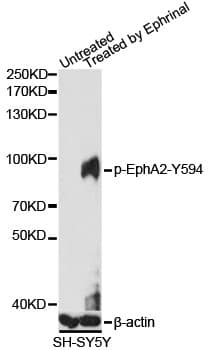 EPHA2 / EPH Receptor A2 Antibody (phospho-Tyr594)