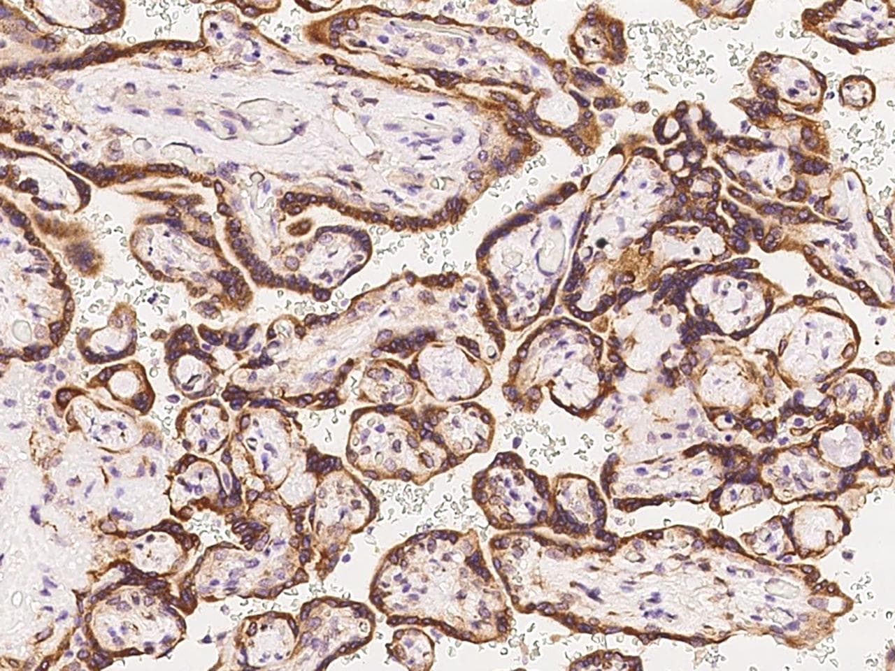 Polyclonal Rabbit anti-Human WFS1 Antibody (IHC)