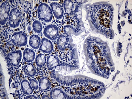 CD2 Antibody (clone UMAB6)