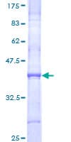 Human COL11A2 / Collagen XI Protein (Recombinant GST, N-terminus)