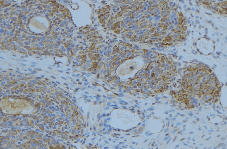 LIPC / Hepatic Lipase Antibody