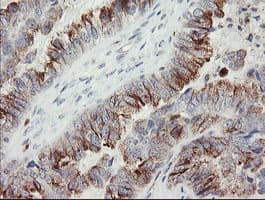 PHKG2 Antibody (aa1-216, clone OTI1F9)