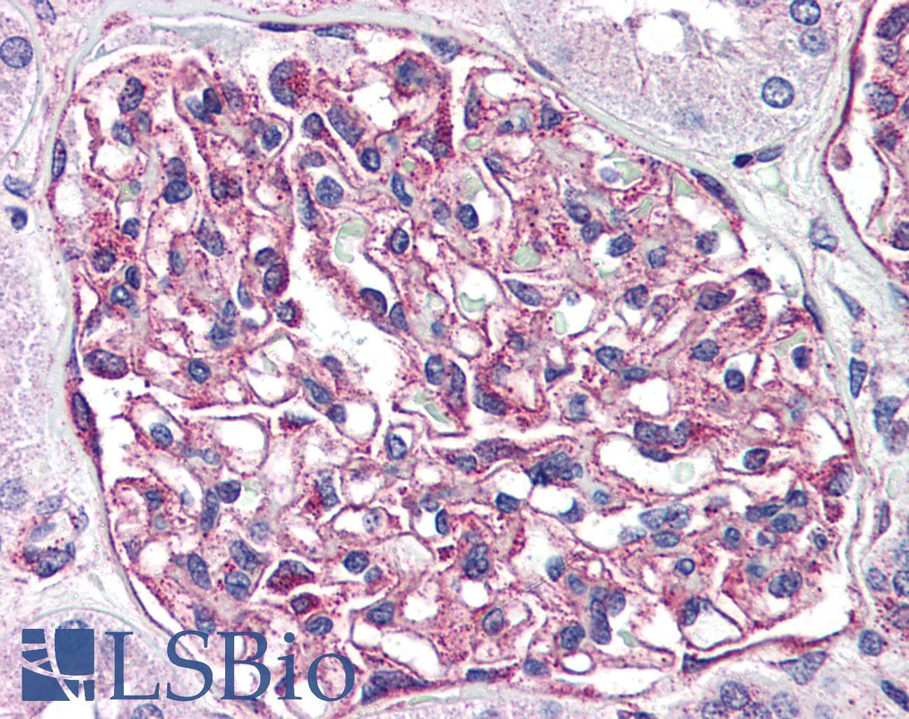 IHC-plus™ Polyclonal Rabbit anti-Human ADGRF5 / GPR116 Antibody (Internal, IHC)