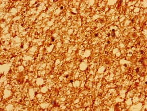 Polyclonal Rabbit anti-Human PSD Antibody (IHC, WB)