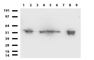 Monoclonal Mouse anti-Human Vimentin Antibody (clone UMAB159, Carrier-free, aa210-466, IHC, IF, WB)