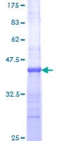 Human IL1R1 Protein (Recombinant GST, N-terminus)
