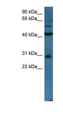 Polyclonal Rabbit anti-Human TLX2 / NCX Antibody (N-Terminus, WB)