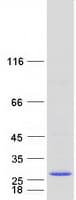 Human RER1 Protein (Recombinant Myc-DDK (Flag))