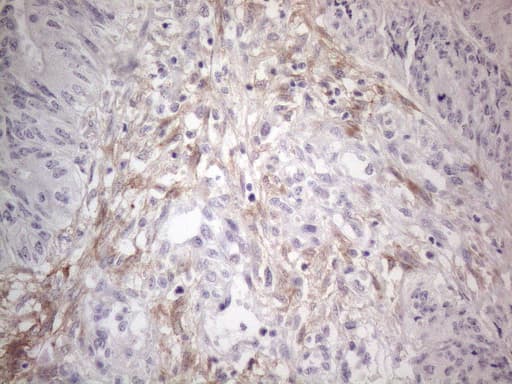 PDGFRA / PDGFR Alpha Antibody (aa789-1089, clone OTI1C10)