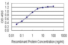 HOXB6 Antibody (clone 8E3)