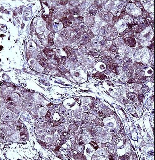 TS / Thymidylate Synthase Antibody (aa265-294)