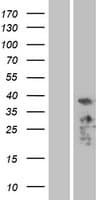 PDLIM3 Protein (Over-Expression Lysate Myc-DDK (Flag))