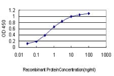 IHC-plus™ SRPK1 Antibody (clone 6H5)