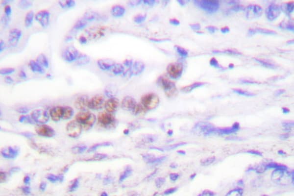 C/EBP Beta / CEBPB Antibody (Ser229)