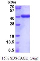 Human GAPDH Protein (Recombinant His)
