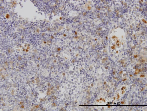 Monoclonal Mouse anti-Human FGR Antibody (clone 3F2, IHC, WB)