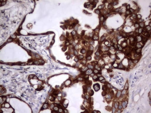 Acidic Cytokeratin Antibody (clone 7F10)