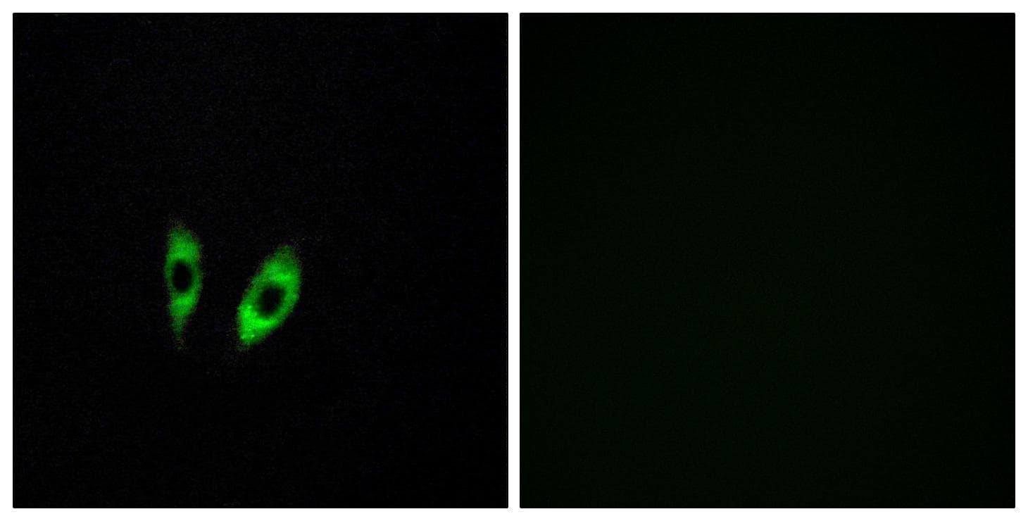 GPR156 Antibody