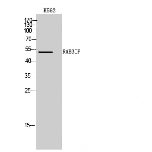RAB3IP / RABIN3 Antibody (230-310 aa, Internal)