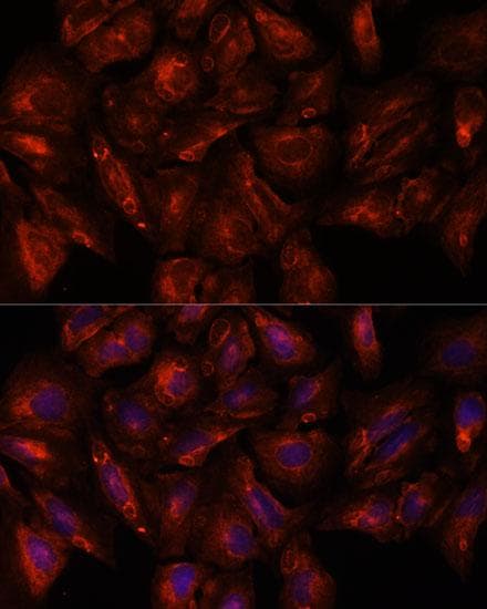 Polyclonal Rabbit anti-Human ITSN2 Antibody (IF, WB)