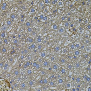 Polyclonal Rabbit anti-Human VEGFC Antibody (IHC, WB)